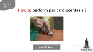 pericardiocentesis interventionalcardiology emergency [upl. by Raybin]