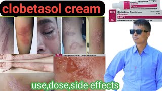 clobetasole creamointment use in nepalihiw to use clobetasol creamointmentcosmelite cream [upl. by Squier515]