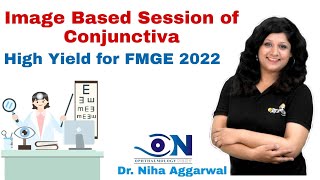 Image Based Session of Conjunctiva  Dr Niha Aggarwal [upl. by Prosperus]