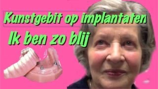 Kunstgebit op implantatenhet klikgebit gemaakt in Amsterdam Zuidoost [upl. by Kcirted]