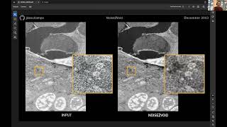 What are AutoEncoders in deep learning  explained [upl. by Ursi]