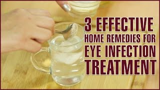 3 Easy amp Effective Home Remedies For EYE INFECTION TREATMENT [upl. by Zorine]