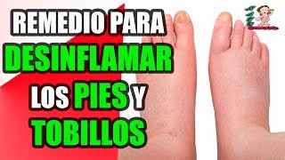 Remedios Caseros Para Desinflamar Los Pies Y Tobillos [upl. by Marchall856]