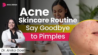 Acne Skincare Routine  Reasons of Acne on Face  Acne Treatment in Greater Kailash  Soul Derma [upl. by Darda771]