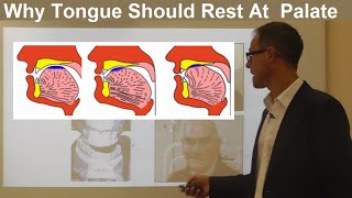 Should Tongue Rest Touch at the Palate Maxilla Roof of the Mouth By Dr Mike Mew [upl. by Handel]