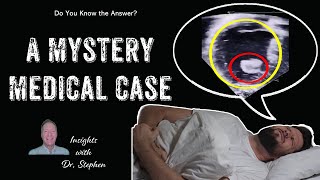 Abdominal Pain Medical Mystery Case with a Surprise Twist [upl. by Gytle366]