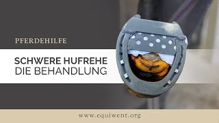 Schwere Hufrehe Hauptfilm – Hufrehe Hufbeinsenkung Ausschuhen – die Behandlung [upl. by Sajovich504]