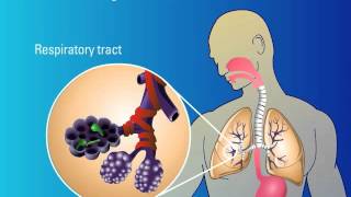 Recognition of Fungi and Activation of Immune Response [upl. by Niwri]