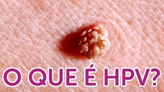 Tudo que você quer saber sobre HPV [upl. by Mischa]