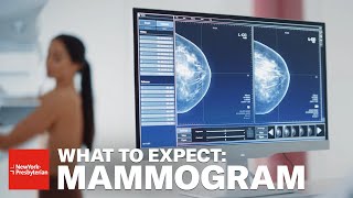 Mammogram What to Expect [upl. by Assirat]