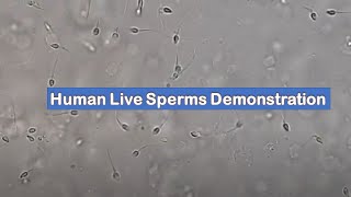 Human sperms under the Microscope at low power fields [upl. by Noral]