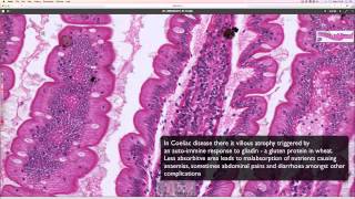 Histological transition from stomach to duodenum [upl. by Ahsiened]