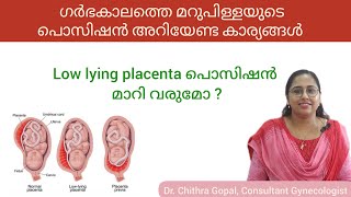 Placenta position during pregnancy malayalam drchithra placenta [upl. by Slaohcin534]