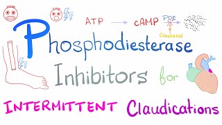 Intermittent Claudications Management [upl. by Cristoforo650]