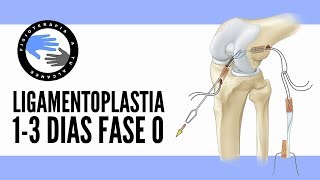 FASE 0 Ligamentoplastia rehabilitacion para la operacion del ligamento cruzado anterior [upl. by Enileda]