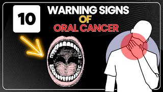 10 Warning Signs of Oral Cancer  Symptoms of Oral Cancer [upl. by Orvan362]