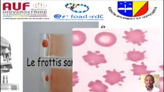 MORPHOLOGIE EN HEMATOLOGIE EPISODE 2 [upl. by Akilegna]