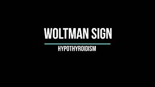 Woltman sign [upl. by Spieler]