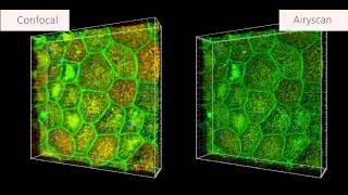 ZEISS LSM 880 with Airyscan Human intestinal stem cells [upl. by Arracat]