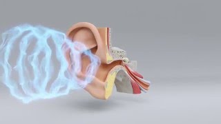 Explore the Science of Hearing Loss  MiracleEar Hearing Center [upl. by Valiant754]