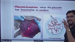 ABNORMALITIES OF PLACENTA AND CORD [upl. by Northway479]