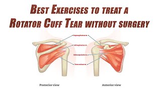 Best SelfTreatment of a Rotator Cuff Tear  Shoulder Rehab without Surgery [upl. by Julienne997]