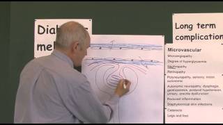 Diabetes 19 Microvascular Complications [upl. by Sirtaeb]