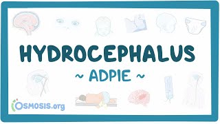 Hydrocephalus Nursing Process [upl. by Malkin641]