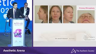 Dr Ahmad Paper Presentation at Aesthetic Meeting Apr 2023 [upl. by Ybanrab]