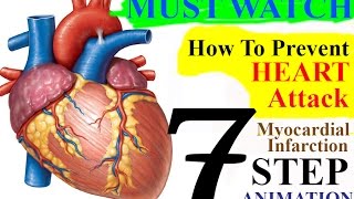 Must Watch 7 Points to Prevent Heart Attack Animation 01 [upl. by Mag]