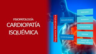 Fisiopatología  Isquemia miocardica [upl. by Arata]