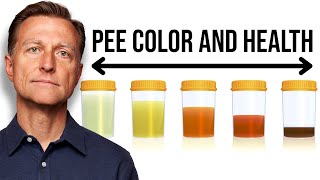 What Your URINE COLOR Says about Your Health [upl. by Dunc951]