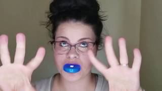 how to bleach your teethTeeth Whitening Kit review glam or scam [upl. by Hadwyn928]