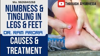 Leg Numbness Paresthesia Treatment  पैर सुन्न होना पेरेस्थेसिया  पैर सुन्न होने पर क्या करें [upl. by Laith]