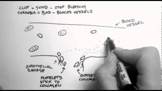 Haemostasis 1  Clots Thrombi amp Antiplatelets [upl. by Cirdec332]