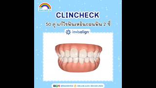 CLINCHECK 50 คู่ แก้ฟันเหยิน  ถอน 2 ซี่  ทันตกรรมฟ้าใส จัดฟันระยอง [upl. by Jeri]