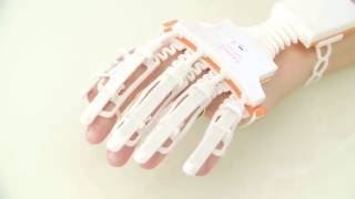 Upper Body Rehabilitation  SMART GLOVE Overview  NEOFECT [upl. by Udall]