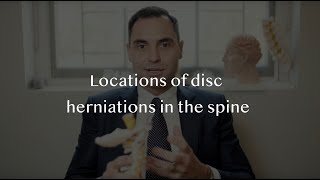 Herniated spinal discs  Where do disc prolapses occur [upl. by Kleiman]