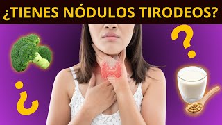 ¿TIENES NÓDULOS TIROIDEOS síntomas diagnóstico y tratamiento [upl. by Clim]