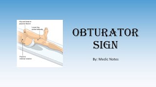 Obturator sign pathophysiology [upl. by Zahavi]