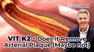 Vit K2  Does it Remove Arterial Plaque [upl. by Gottlieb]