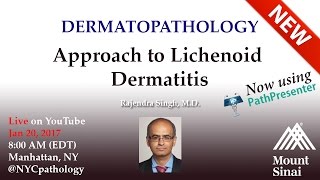 Dermatopathology Approach to Lichenoid Dermatitis  w Dr Singh [upl. by Eltsyrk]