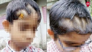 Vikhroli’s KVV school punishes students cuts their hair unevenly  Mumbai Live [upl. by Nossaj]