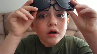 Strabismus Eye Surgery  6 Year Old Both Eyes [upl. by Yarased718]