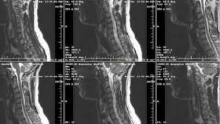 XRays CT Scans amp MRIs  What Are They [upl. by Enelram630]