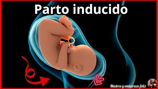 PARTO INDUCIDO  Como Parir  PASO A PASO Contracciones y mas [upl. by Reyem928]