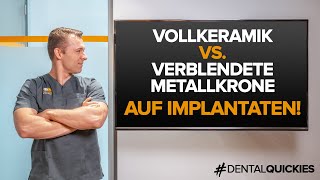 Was ist besser Vollkeramikkrone oder Metallverblendkrone auf Implantaten Wir klären auf [upl. by Ewer590]