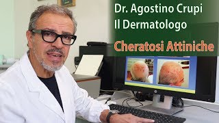 Agostino Crupi  Le Cheratosi Attiniche come curarle [upl. by Jarrett]