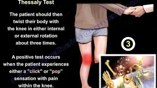 Meniscal Tears Examination amp Tests  Everything You Need To Know  Dr Nabil Ebraheim [upl. by Farrison41]