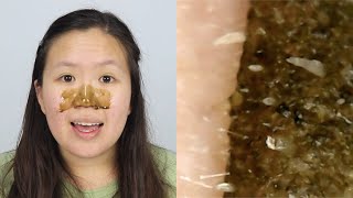 VZA Green Tea Blackhead Peel Off Mask  UNDER A MICROSCOPE [upl. by Gothurd434]